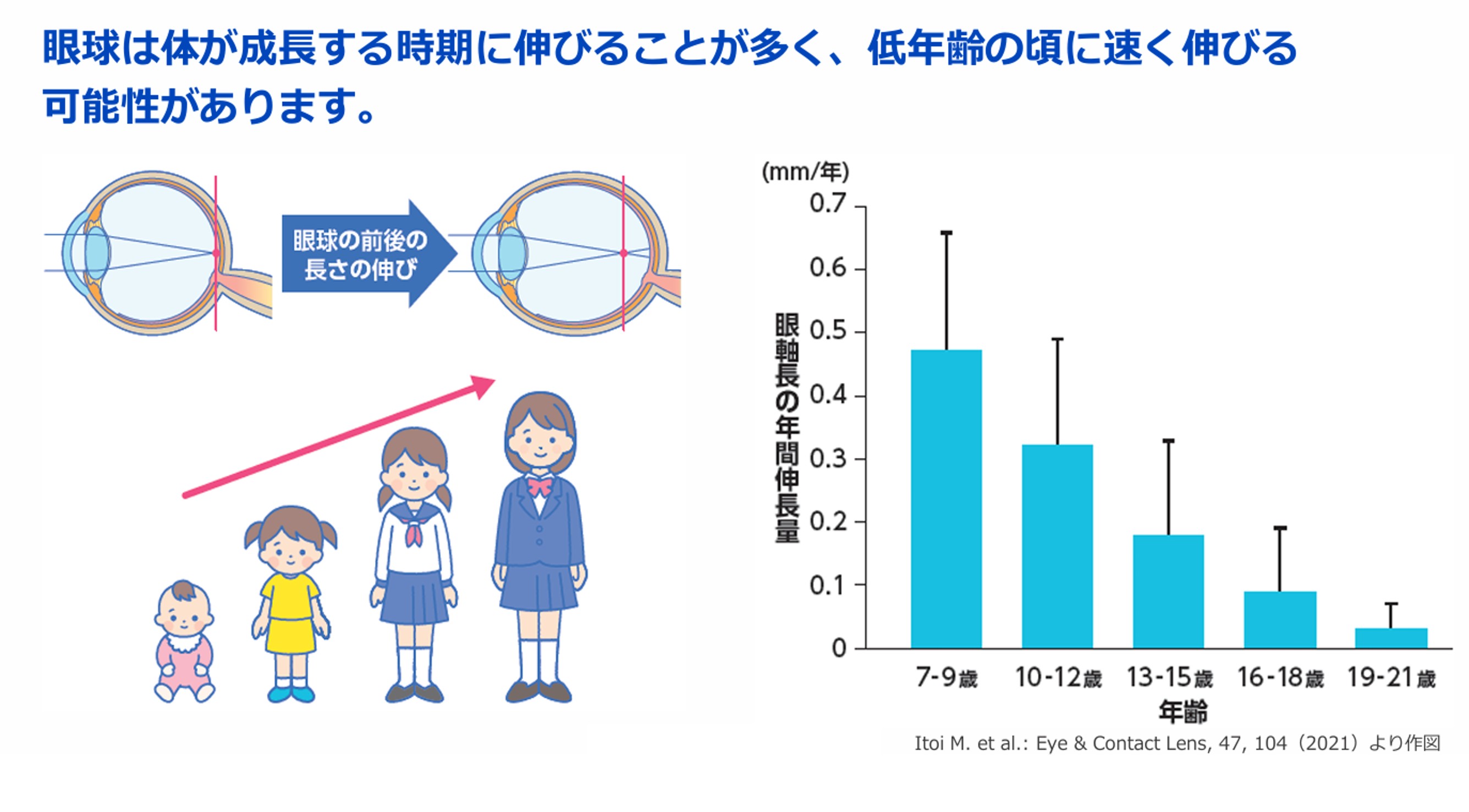 眼球は体が成長する時期に伸びることが多く、低年齢の頃に速く伸びる可能性があります。