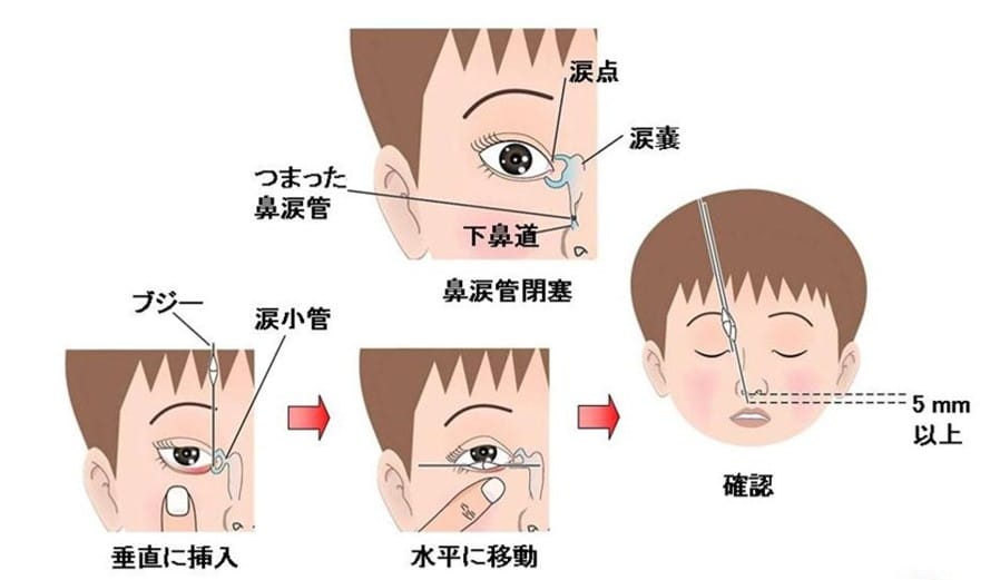 小児・乳児・新生児外来｜岐阜市北島の眼科 恩田眼科クリニック｜白内障手術、コンタクトレンズ処方